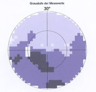 Gesichtsfeld mit AION-typischen Gesichtsfeldausfällen